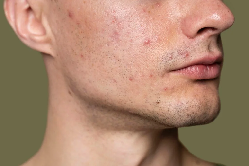 Ilustrasi tekstur kulit wajah dan pori-pori