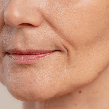 Penuaan _ Kontur Wajah (Aging _ Face Contouring)